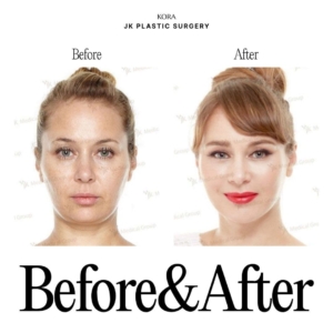 JK Plastic Surgery_Anti-aging surgery 1