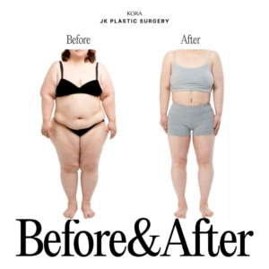 JK Plastic Surgery_Body liposuction, Tummy tuck 1