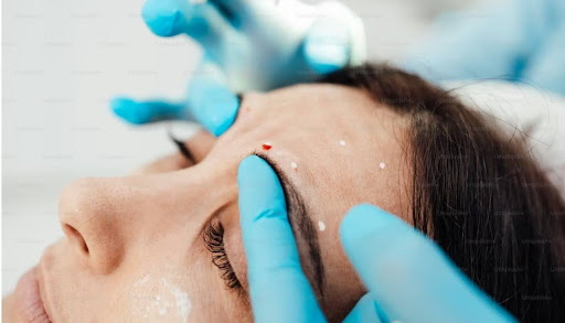 injection areas