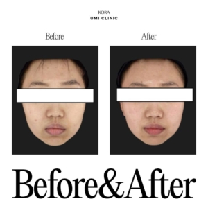Dr. Jong Woo Yoon_Pigment care