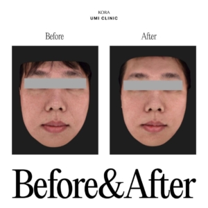 Dr. Jong Woo Yoon_Skinvive